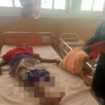 குளவிக்கொட்டு: 4 தொழிலாளர்கள் பாதிப்பு